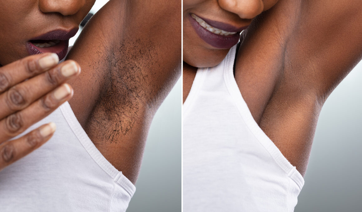 Unwanted Hair