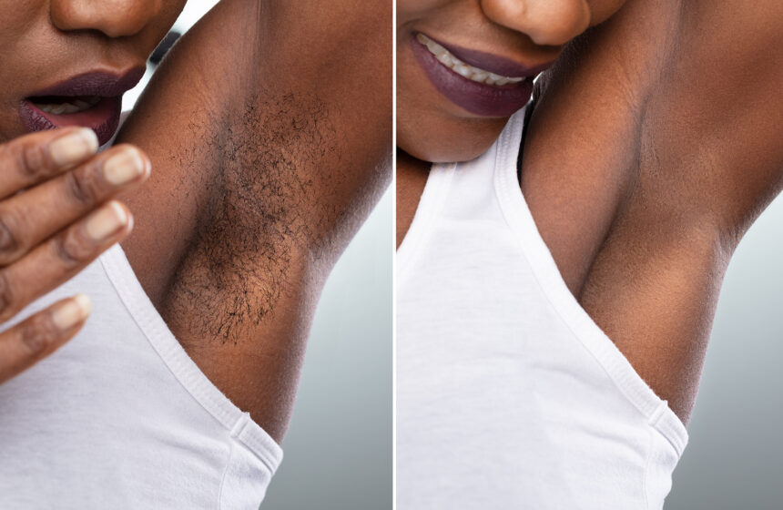 Unwanted Hair